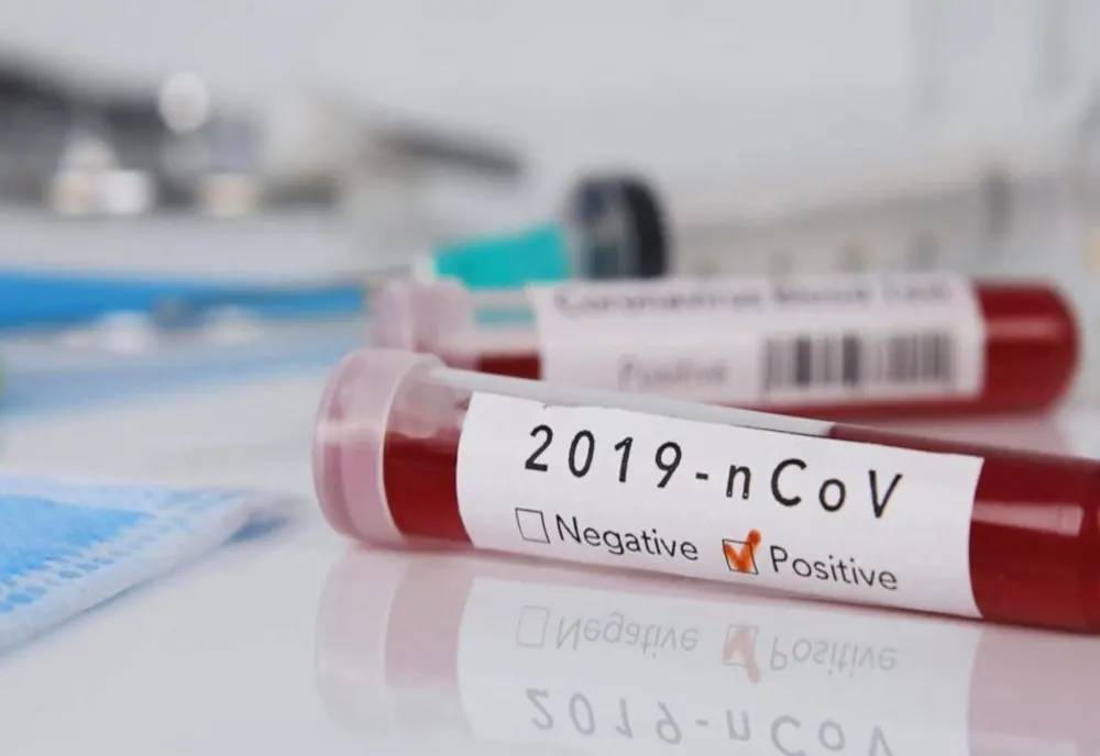 Numărul persoanelor confirmate cu coronavirus a ajuns la 10 