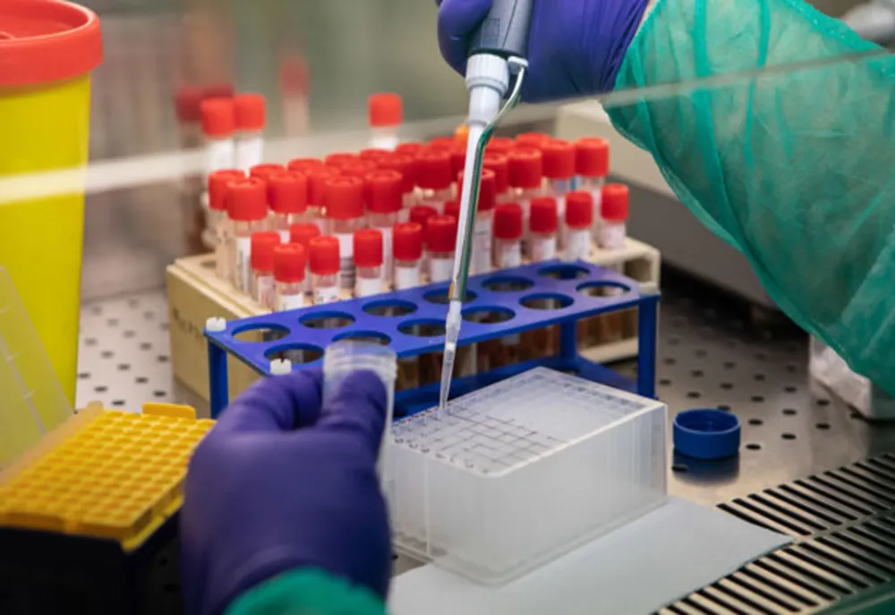 Încă un caz de coronavirus a fost confirmat în Sălaj 
