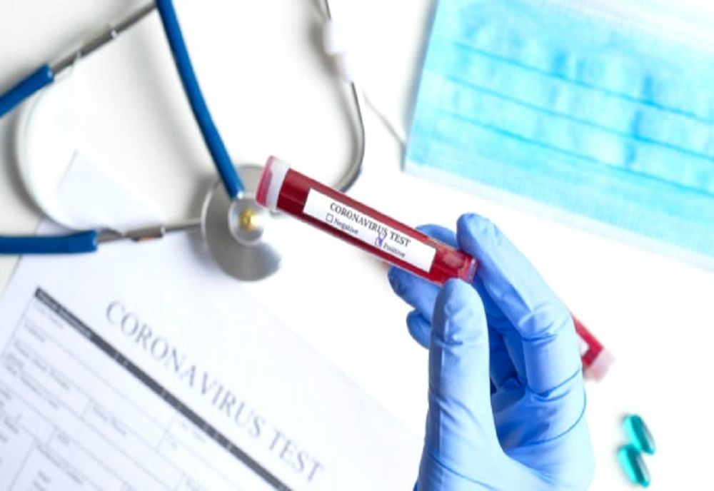 6.333 de cazuri noi de infectare cu SARS-COV-2, în ultimele 24 de ore! 148 de decese au fost raportate