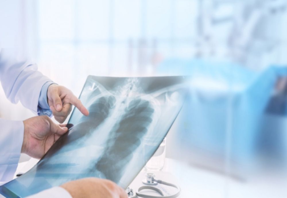 EXPLOZIE DE CAZURI DE PNEUMONIE, ÎN ROMÂNIA: COPIII, CEI MAI AFECTAȚI