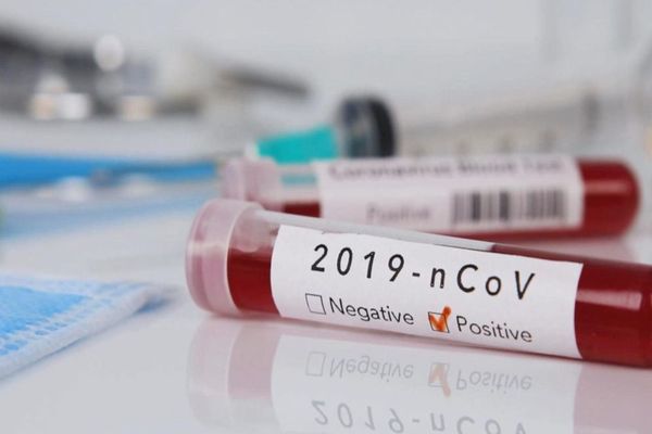 A fost înregistrat cel de-al treilea deces din cauza CoVid-19, în România! Teoretic, bărbatul nu a intrat în contact cu vreo persoană infectată și nici nu a călătorit