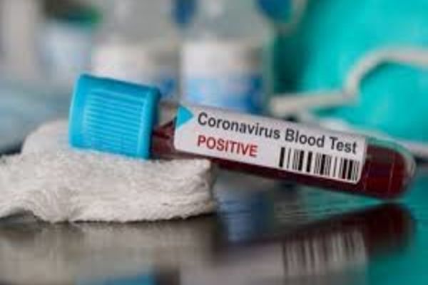 Organizația Mondială a Sănătății a declarat pandemie de coronavirus