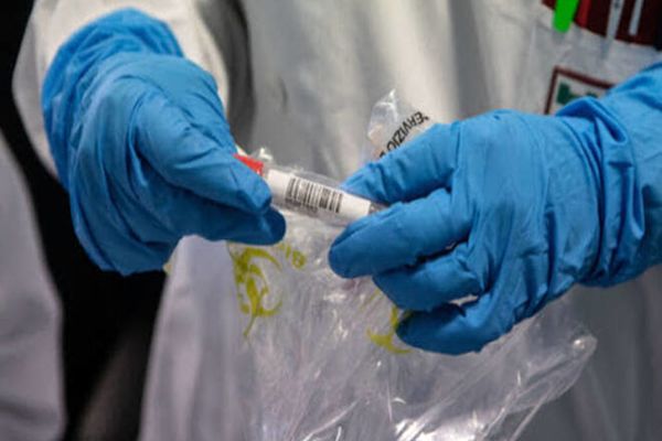 Pacienții COVID asimptomatici vor putea fi tratați la domiciliu