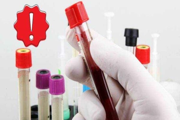 ASISTENTĂ INTERZISĂ LA DONARE, DUPĂ CE A DONAT 63 DE LITRI DE SÂNGE. MOTIVUL ESTE ABSOLUT ȘOCANT. CRTS O INVITĂ PENTRU CLARIFICAREA SITUAȚIEI