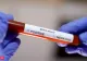  Niciun caz nou de îmbolnăvire cu coronavirus în Sălaj 
