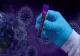 Bilanț coronavirus: 2.358 de cazuri noi de COVID-19 şi 34 de decese, înregistrate în intervalul 23 - 29 ianuarie